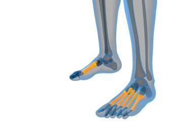 3D render Medikal illüstrasyon metatarsal kemik
