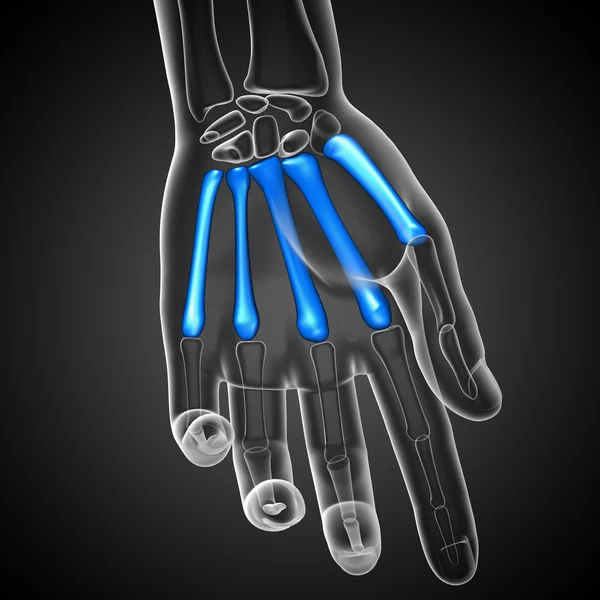 3d render ilustrasi medis dari tulang metacarpal — Stok Foto