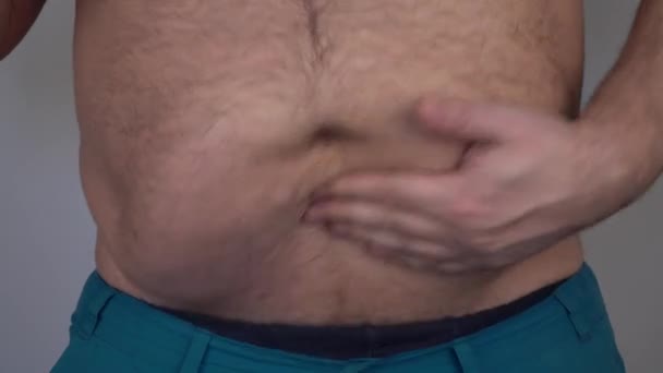 Hombre Abofetea Gran Barriga Con Sus Manos Problemas Obesidad Exceso — Vídeo de stock