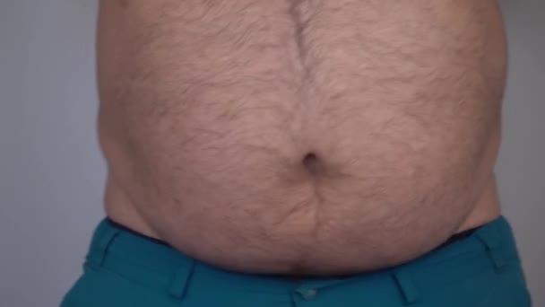 Homem Mostra Sua Barriga Grande Sacode Suas Dobras Gordas Problemas — Vídeo de Stock