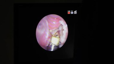 Bir insanın içindeki kameradan alınan video.