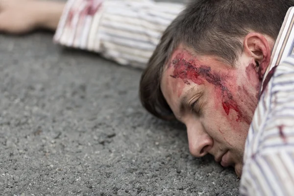 Herido hombre después de accidente de coche —  Fotos de Stock