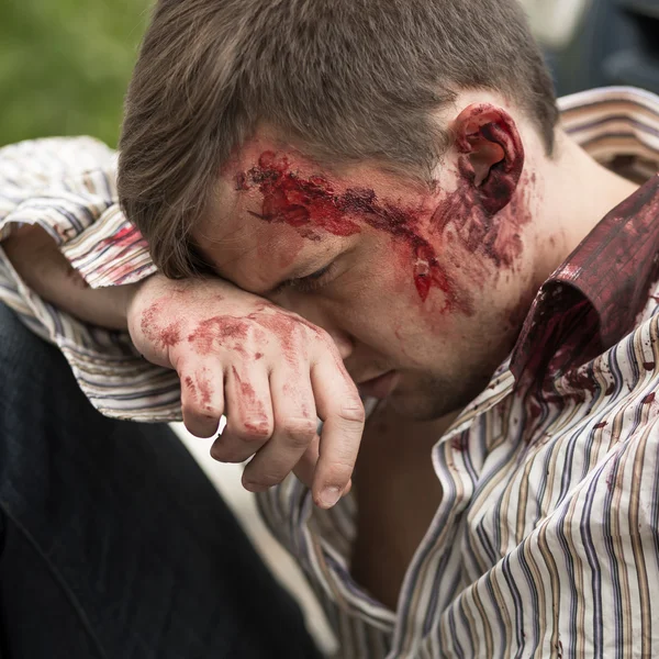 Injured man after car crash — Stock Photo, Image