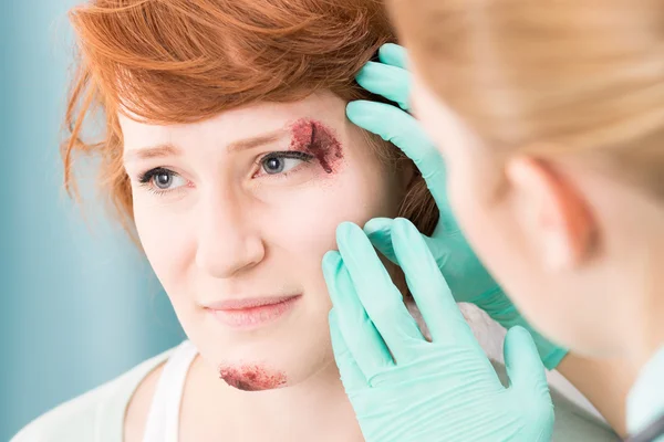 Girl with wound on face — Stock Photo, Image