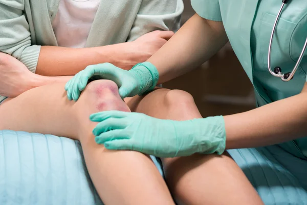 Gekneusd vrouwelijke knie — Stockfoto