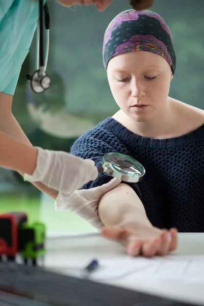 Woman with cancer during mole examining — Stock Photo, Image