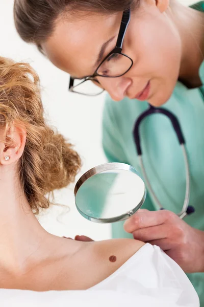 Dermatologista examinando uma toupeira — Fotografia de Stock