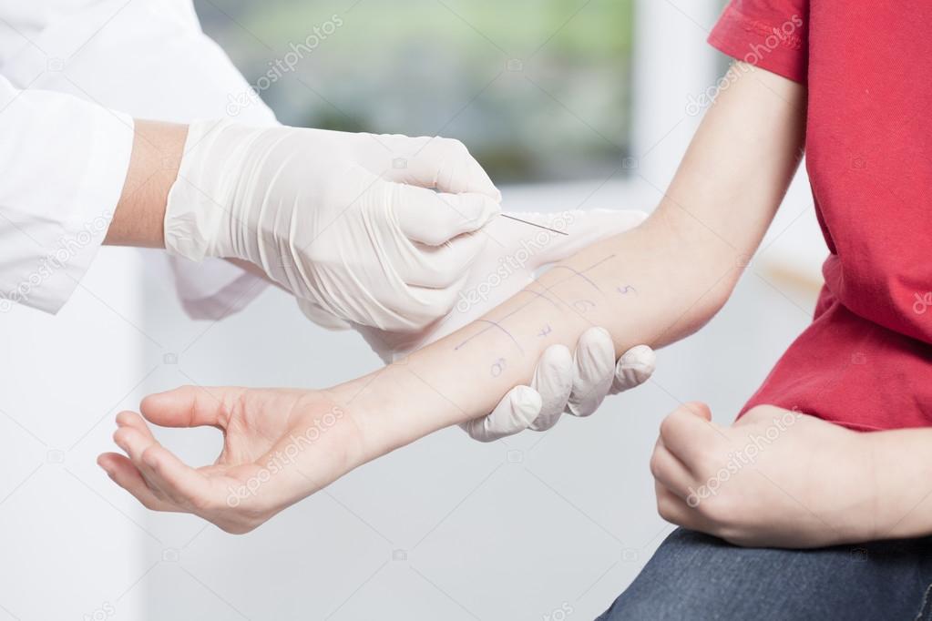 Doctor's hands doing allergy test