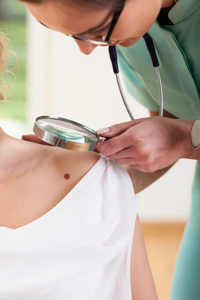 Checking for melanoma — Stock Photo, Image