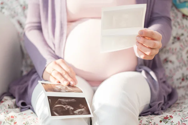 Nahaufnahme eines Ultraschallfotos — Stockfoto