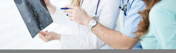 Jovens médicos analisando RM cerebral — Fotografia de Stock