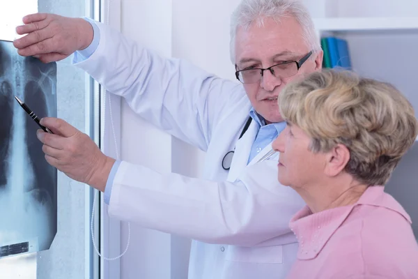 Mujer mayor con cáncer de pulmón — Foto de Stock