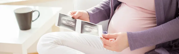 Ultraschallbild des Babys — Stockfoto