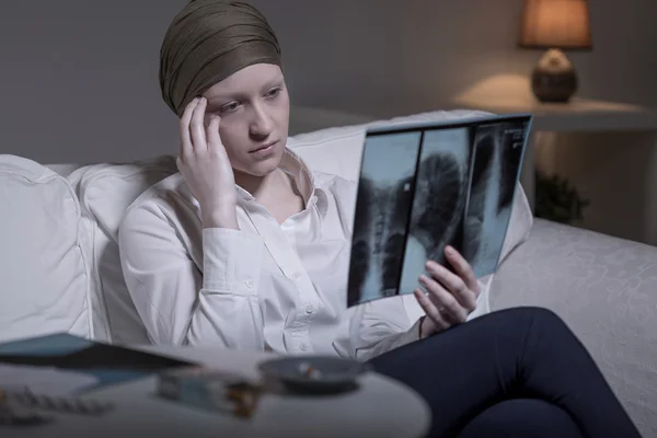 Worried woman and xray — Stock Photo, Image