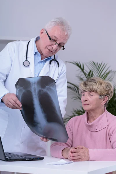 Womans tüdő röntgenfelvétel — Stock Fotó