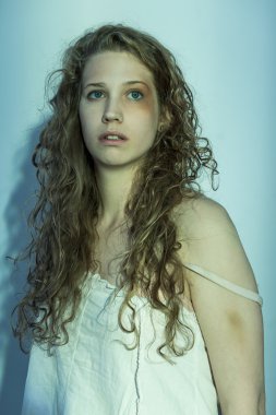 Kız babası tarafından dövüldü