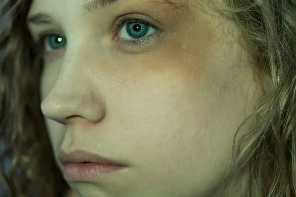 Beaten woman with black eye — Stock Photo, Image