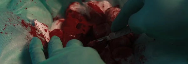 Cirujano durante la operación sosteniendo un bisturí — Foto de Stock