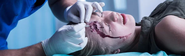 Surgeon stitching up head — Stockfoto