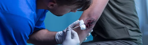 Cirurgião medicando ferida com sangue — Fotografia de Stock