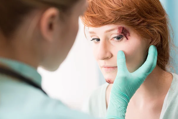 Médico medicando ferida ocular — Fotografia de Stock