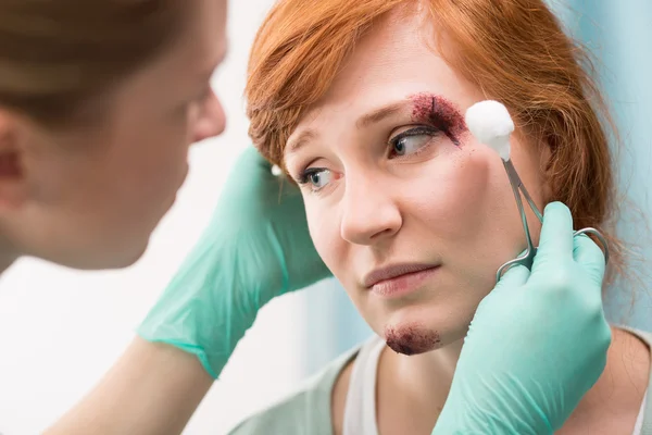 Nurse dressing the wound — Stock Photo, Image