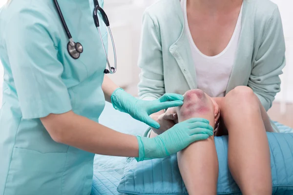 Woman with bruised knee — Stock Photo, Image