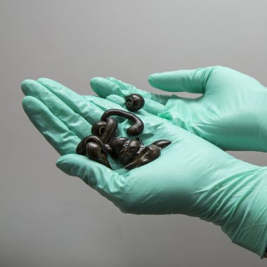 İnsanların tıbbi sülük tedavi.