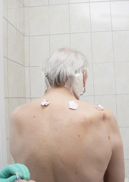 Tratamiento con sanguijuelas zona del hombro y cuello, zona de la espalda en el —  Fotos de Stock