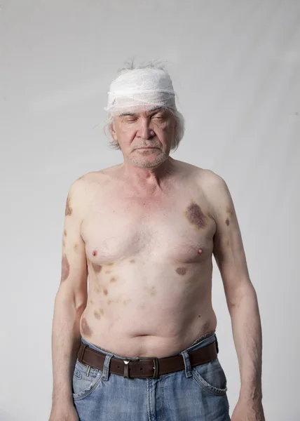 Bandits mutilated man — Stock Photo, Image