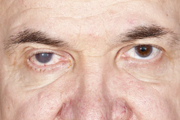 Ophthalmologic examination of middle-aged men — Stock Photo, Image