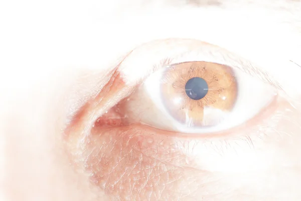 Senile cataract oog onderzoek — Stockfoto