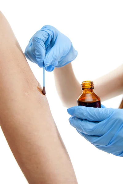 Nurse applying  iodine — Stock Photo, Image