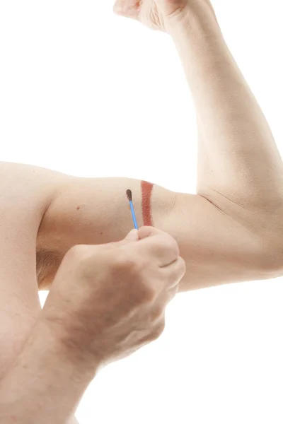 Mão masculina aplicando iodo — Fotografia de Stock