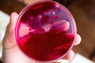 Koli basili bakterisinin el ele tutuşması veteriner muayenehanesinde izole edilir.