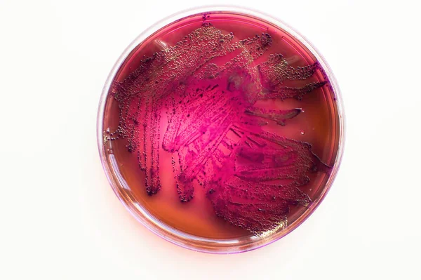 Fenotypiska egenskaper hos Escherichia coli-bakterier på selektiva medier — Stockfoto