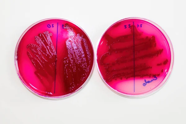 E coli bakterier växa egenskaper på selektiva medier — Stockfoto