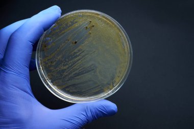 bacterial colonies of Salmonella on selective medium plate on black background