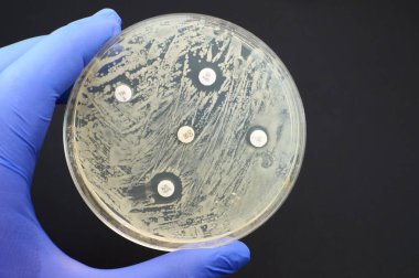 Detecting antimicrobial resistance by Kirby Bauer diffusion test