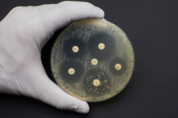 Antimicrobial susceptibility test by diffusion test petri dish black background