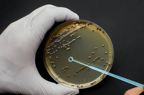 Bilim adamı, tek kullanımlık döngülü tek bir bakteri kolonisi buldu.