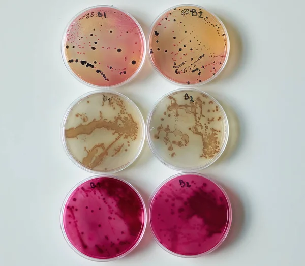 Bakteriekoloni på selektiva medier Sockerplattor i petriskål — Stockfoto