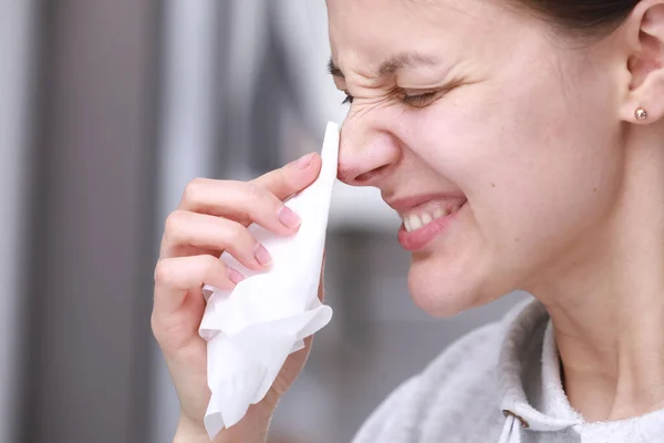 Herpes Nose Pretty Young Woman Feels Discomfort Herpes Her Face — Stock Photo, Image