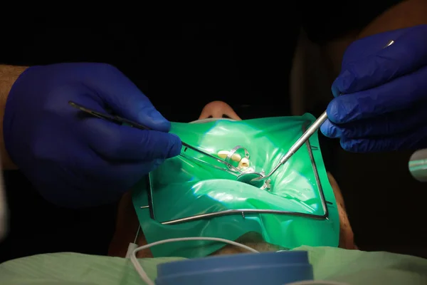 Close up of man open mouth while doctor is using mirror for better teeth examination. Careful male doctor applying at the patient mouth special equipment to fixing his tongue