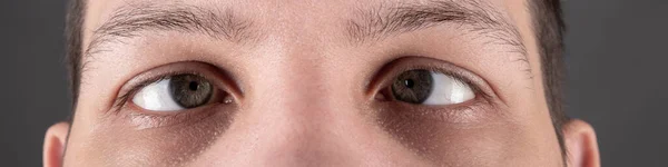 Squint strabismus in a man panorama close-up — Stock Photo, Image