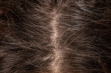 Kadın baş kökleri hangi gri saçların görünmeye başladığı konusunda yakınlaşır