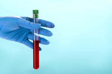 Elinde bir şişe kan tutan bir doktorun eli..