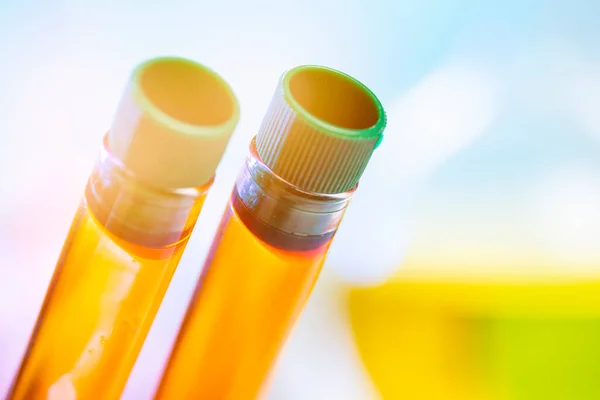 Due provette chimiche con coperchi chiusi con liquido arancione su fondo blu. Test delle urine, somministrazione di urina — Foto Stock