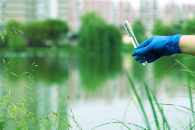 Eldivenli bir el test tüpüne su toplar. Şehrin su kaynağındaki açık sudan örnek almak. Bilim adamı ya da biyolog, bir şehir manzarasının arka planına karşı test tüpünde su örneği alıyor.