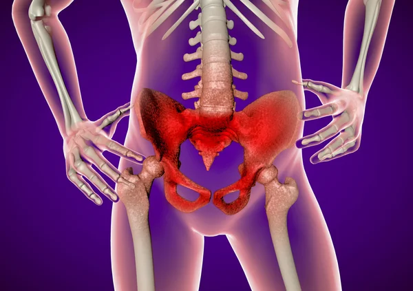 Pain in hip and pelvis — Stock Photo, Image
